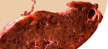 liver.png